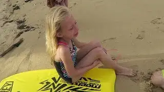 Painful Jellyfish Sting