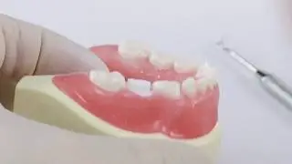 Pediatric Zirconia Crown Technique | Posterior