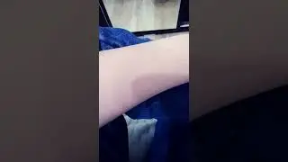 Мне было очень больно это оттирать бедные мои волосы на руке 