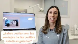 Ventajas carillas guiadas