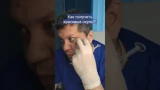 Как сделать красивые скулы? Контурная пластика.
