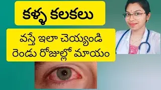 కండ్ల కలకలు | Conjunctivitis | pink eye symptoms | precautions | treatment  @drvidyashealthtips