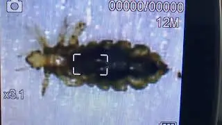 Live Lice - Head Check Results