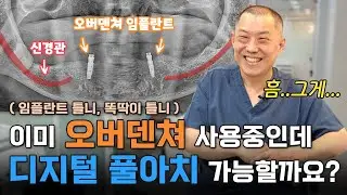 👿 불편했던 임플란트 틀니에서 디지털 풀아치로 바꾸려면 이 영상 꼭 보세요 [2편]