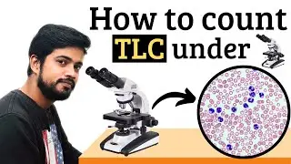 TLC Count in the Microscope, Total Leucocyte Count in Hindi (Slide Method)