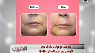 ما يميز مراكز Yes clinic عن غيرة من مراكز التجميل الأخري
