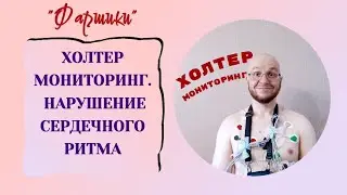 ХОЛТЕР МОНИТОРИНГ. ОПЫТ ОБСЛЕДОВАНИЯ НАРУШЕНИЙ СЕРДЕЧНОГО РИТМА #онкология #холтер #обследование