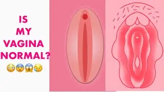 Is Your Vagina NORMAL? 9 Different Types of Labia! Nicky At Your Cervix
