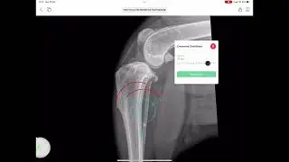 How to find and use the Double Crescentic Cut tool in vPOP PRO ®