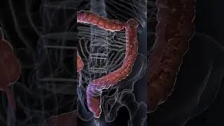 Understanding Diarrhea: Causes, Symptoms, and Management  