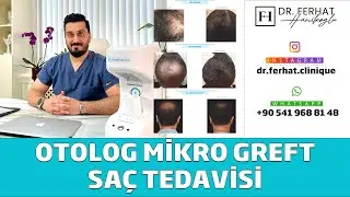 Otolog Mikro Greft Saç Tedavisi ( Regenera Activa )