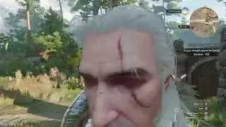 Witcher 3 Closeup Camera Glitch - Help! My game is stuck like this!