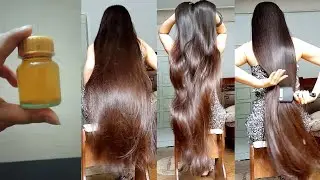 the Indian secret, 🌿 to grow hair at a rocket speed and baldness from the first week,nidi creation