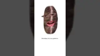 Анимия. Железодефицитная анемия. Симптомы. Сибирское здоровье