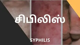 சிபிலிஸ் | syphilis | SEX LESSONS #sex #syphilis #health #bodypositive