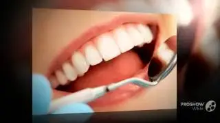 отбеливание зубов в омске отзывы   - Безвредное Отбеливание Зубов. Как?