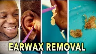 ENDLESS EARWAX REMOVAL! | Dr. Paul (feat. Themba 
