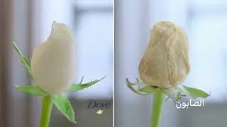 دوڤ يمنح عناية لا مثيل لها