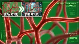 BLOOD VESSELS GREEN SCREEN