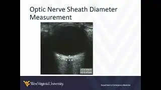 Ocular Point-of-Care Ultrasound 2 - Abnormal Findings