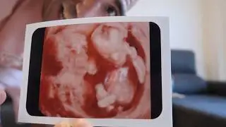 SOMOS PAPÁS DE UNA NIÑA 👧 4 Meses de Embarazo