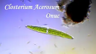 Клостеріум Ацеросум опис