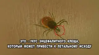 Внимание клещи