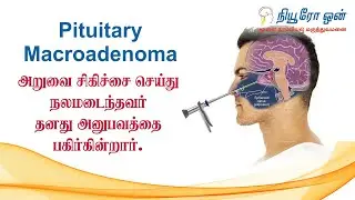 Transform Your Life With Effective Treatment For Pituitary Macroadenoma!