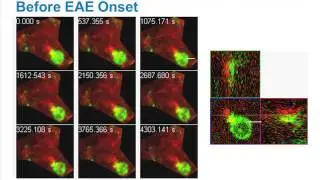 New Research on Immunology of the Cerebrospinal Fluid Compartment and MS