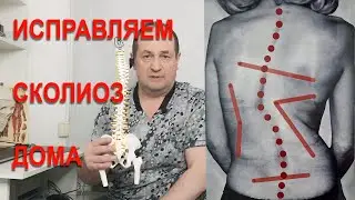 Исправляем сколиоз дома!