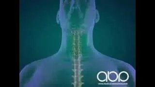 Spine fusion surgery