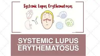 Lupus erythematosus: Ways to adapt to this immune disease