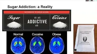 Front of Package Labelling and Endocrine Disorders - Dr Madhukar Mittal, AIIMS Jodhpur