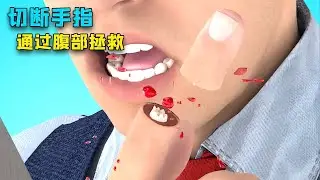 被切断的手指可以用肚皮进行保存养殖