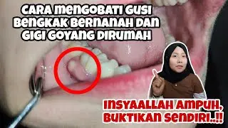 Cara Ampuh Mengobati Gusi Bengkak Bernanah pada Orang Dewasa di Rumah