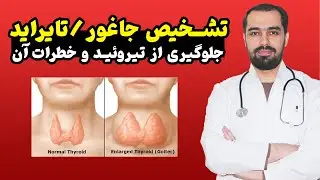 روش های تشخیص جاغور یا تایراید | پیشگیری از تیروئید | خطرات تایراید 👨‍⚕️ داکتر عبدالجبار مومنیار