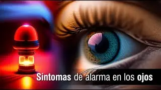 📌 4 síntomas de alarma en los ojos 👁️👨🏻‍⚕️
