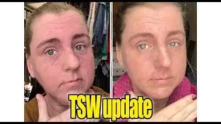 TSW UPDATE- How am I healing?