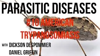Parasitic Diseases Lectures #10: American Trypanosomiasis