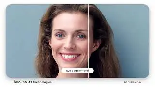 AR Technologies Eye Bag Removal