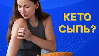 Кето сыпь: причины появления, способы решения проблемы.