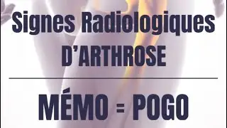 Mémo : Signes radiologiques d’Arthrose