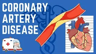 Coronary Artery Disease, Ischaemic Heart Disease and Acute Coronary Syndrome Explained