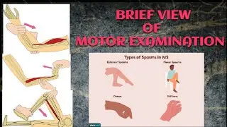 BRIEF VIEW OF MOTOR EXAMINATION #made_easy
