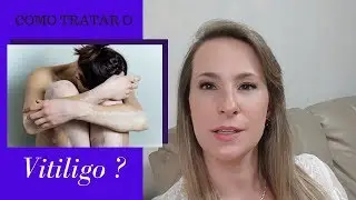 Como TRATAR o VITILIGO ? - Dra Cínthia Orasmo Dermatologista