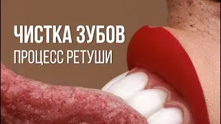 Процесс ретуши зубов