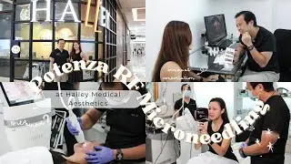 Facial Rejuvenation: Potenza RF Microneedling in Singapore with Dr. Terence Tan