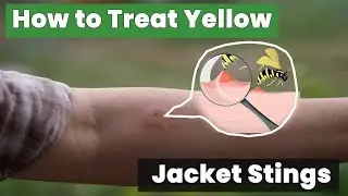 How to Treat Yellow Jacket Stings – Expert Tips You Need to Know!