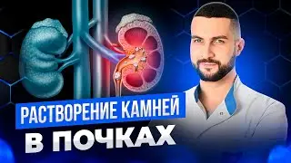 Причины образования камней и как растворить камни в почках без операции и дробления