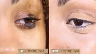 Coverderm как убрать черное пятно на глазах